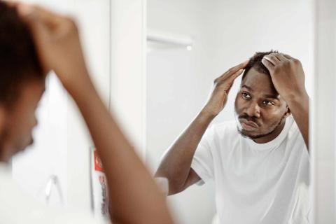 Man checking is hairline in the mirror